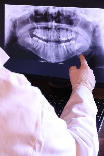 Dentist for Dental Trauma in PA