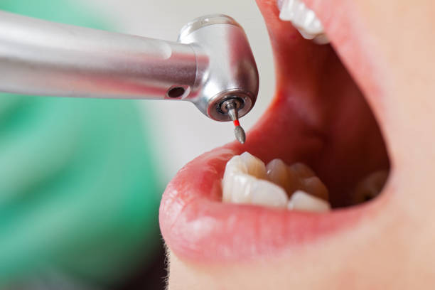 Best Tooth Pain Emergency Relief  in Allison Rk, PA